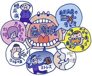 歯周病の危険要因（リスクファクター）を知っておこう!! 練馬区